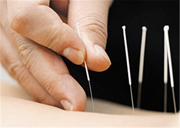 Für den Erfolg der Akupunktur ist die positive Kommunikation entscheidend Nadeln lindert Schmerzen bei Gonarthrose.