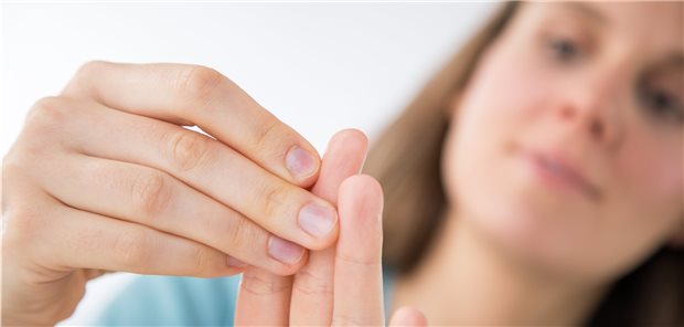 Nagelerkrankung? Eine App soll Zweifelnden jetzt bei der Klärung der Frage helfen.