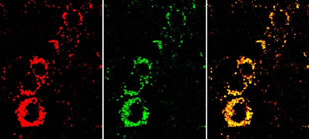 Weniger Tierversuche dank Nanopartikeln Nanosensoren zeigen durch das gelbe Signal im Überlagerungsbild (rechts), dass die Zellen aktiv sind. Wären sie in einem schlechten Zustand , wären sie deutlich roter. Mitte: Signal des Indikatorfarbstoffs. Links: Signal des Referenzfarbstoffs.