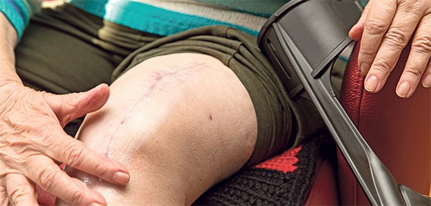 Neues Knie hält Herz in Schuss Narbe nach Kniegelenksersatz: Mit TEP sind Patienten beweglicher und reduzieren so ihr Herz-Kreislauf-Risiko, diskutieren Forscher.