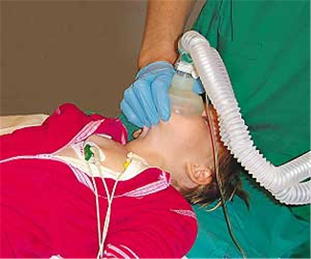 Schaden Vollnarkosen kleinen Kindern? Narkose bei einem Kind - Routine oder Grund zur Sorge?