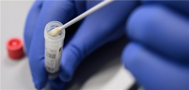 Nasen-Rachen-Abstrich auf SARS-CoV-2