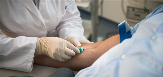 Neben dem Testosteronspiegel sollten bei Verdacht auf Hypogonadismus auch die Gonadotropin-Werte, SHBG, Prolaktin und der PSA-Wert überprüft werden.