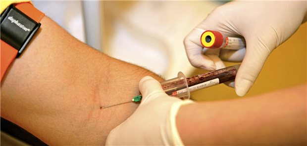 Neben vielen technischen Leistungen gehört auch die Erhebung von Laborwerten zu den Leistungen, um den Gesundheitsstatus von Männern festzustellen. Nach GOÄ abgerechnet, gehört die Blutabnahme aber sicherlich nicht zu den am höchsten bewerteten Leistungen.