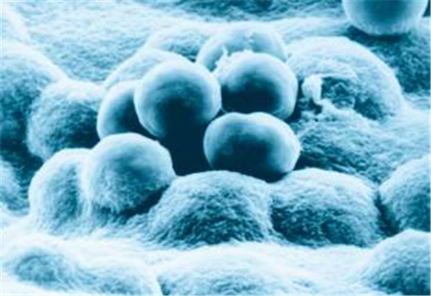 Immer noch stirbt jeder zehnte Patient mit invasiver Meningokokken-Infektion Neisseria meningitidis (Meningokokken) unterm Elektronenmikroskop.