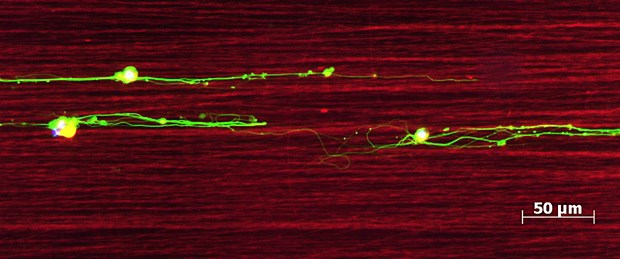 Mit Seidenfasern das Augenlicht retten Nervenzellen der Netzhaut (grün), die in vitro an elektrisch gesponnenen Seidenfäden (rot) entlangwachsen.