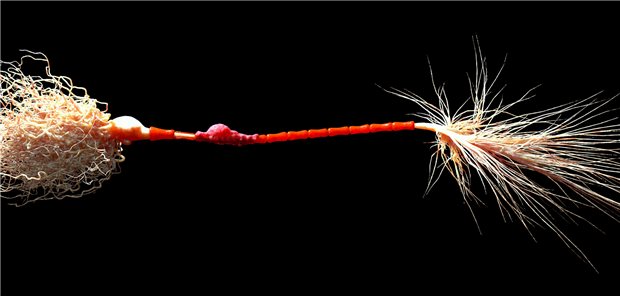 Nervenzellen mit Myelinscheiden (rot): Propionat kann die Zellen nach Laborbefunden vor oxidativem Stress schützen.
