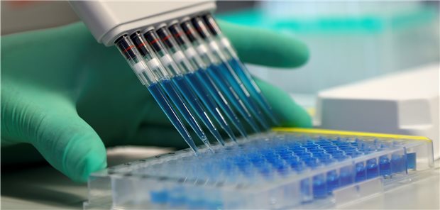 Nette Pipetten: Im ELISA-Assay auf der Suche nach SARS-CoV-2