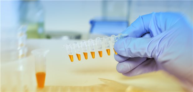 Neu entdeckte Biomarker könnten dabei helfen, den Beginn einer sekundär progredienten MS zu erkennen.
