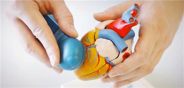 Neuartiger Stoßwellenkopf auf einem Herzmodell: Der Prototyp wurde von den Herzchirurgen in Innsbruck entwickelt. 