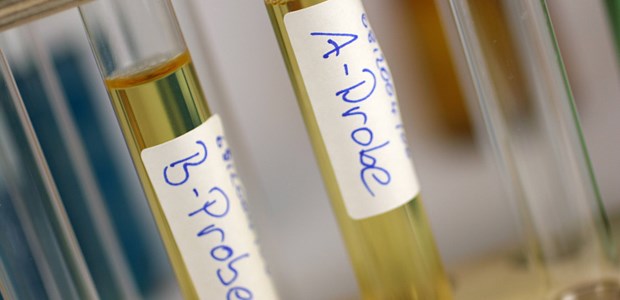 Vom Kavaliersdelikt zur Straftat? Neue Analysemethoden können auf die Spur von Doping führen - doch oft wird das Analysesystem nicht ganz ausgenutzt, beklagen Experten.