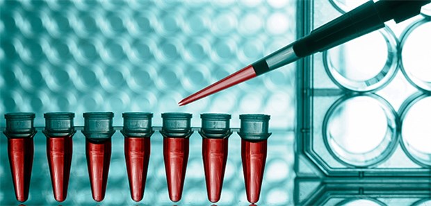 Neue Gentherapien sind im Zulassungsverfahren, einige Produkte schon zugelassen.