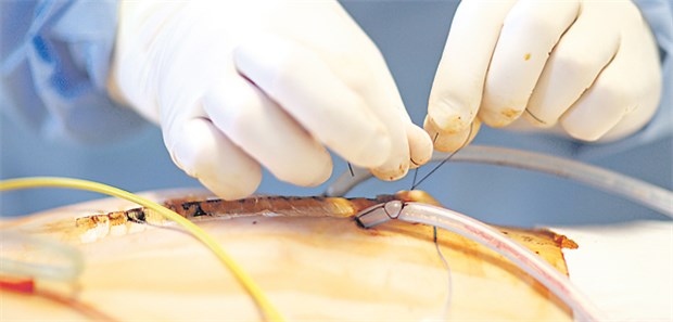 Neue Konnektoren sollen Fehlanschlüsse verhindern.