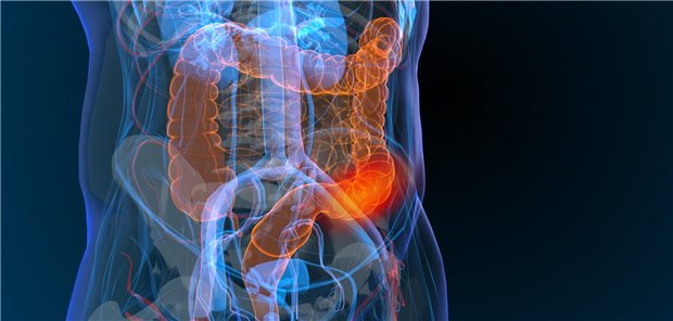Neue Testmethoden für das Darmkrebsscreening, sind ein Multitarget-Tests (mtFIT) von Team um Dr. Thomas Imperiale, der neben Hämoglobin eine Reihe methylierter DNA-Marker (LASS4, LRRC4, PPP2R5C und ZDHHC1) nachweist und ein Test über zellfreie Tumor-DNA (ctDNA) vom Team um Dr. Daniel Chung, der bestimmte Tumormutationen wie KRAS und APC erkennt, ebenso ungewöhnliche Methylierungen und auffällige Fragmentierungsmuster.