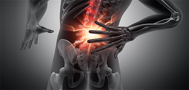 Forscher identifizieren Ursache für chronisches Rheuma Neuer Therapieansatz möglich: Forscher sind der rheumatoiden Arthritis auf der Spur.