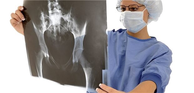 Neues Hüftgelenk? 52 Prozent der Ärzte, die für die Studie befragt wurden, halten bei der Indikation „Hüftgelenkersatz“ ein Zweitmeinungsverfahren für sinnvoll.