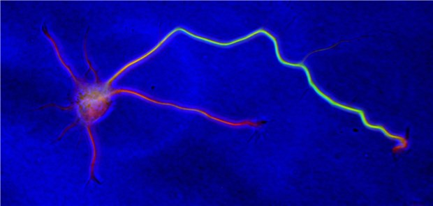Intelligente Menschen haben weniger Nervenzellverbindungen Neuron mit Dendriten (rote Fortsätze) und Axon (grün). Informationen werden von den Dendriten gesammelt und im Zellkörper gebündelt. Das Axon leitet sie wie ein langes Kabel an benachbarte Zellen weiter.
