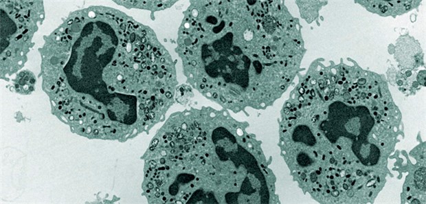 Neutrophile unter dem Elektronenmikroskop: Eine Neutrophilie korreliert bei COPD-Patienten mit einer schlechtenLungenfunktion.
