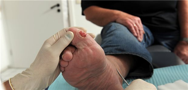 Nicht nur Diabetespatienten profitieren von einer strukturierten Wundversorgung.