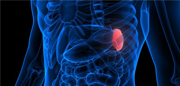 Neuer JAK-Inhibitor speziell bei Myelofibrose-assoziierter Anämie Nicht nur das Milzvolumen wird bei Myelofibrose-assoziierter Anämie durch eine Behandlung mit Momelotinib günstig beeinflusst.