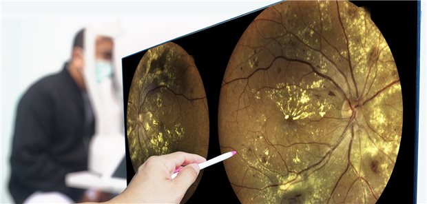 Eine Retina-Aufnahme wird befundet.