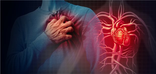 Nicht wenige Herzinfarkte verlaufen tödlich, meist jedoch überleben davon betroffene Patienten heute das Infarktereignis