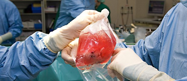 Barmer will weniger Zentren Niere auf dem Weg: Nach dem Willen der Barmer GEK braucht es weniger Transplantationszentren.