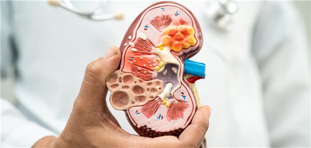 Niere im Blick: Gerade bei Diabetikern lohnt es sich, auch an eine Nephropathie zu denken.