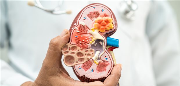 Niere im Fokus: Eine erhöhte Albuminurie zeigt schon frühzeitig und auch unabhängig von der eGFR einen Nierenschaden an.