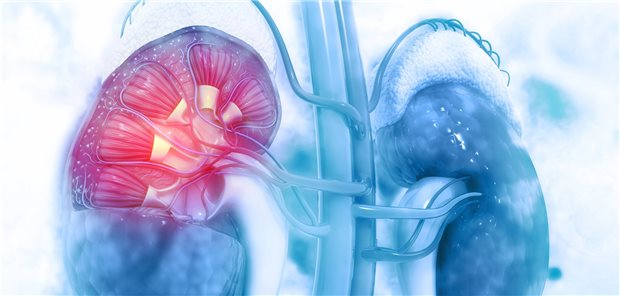 Niere im Fokus bei HIV-Patienten: Vor allem auf die Nierenwerte Cystatin C und Kreatinin sollte geachtet werden.