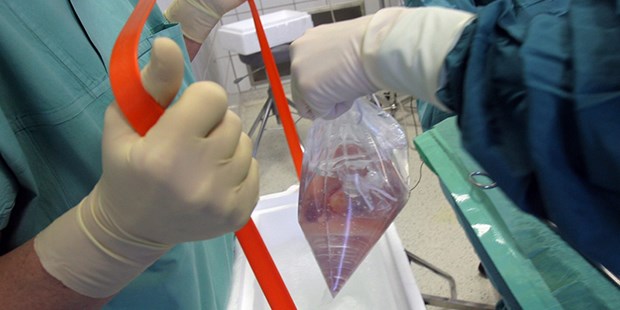 BÄK-Rolle in der Kritik Niere zur Transplantation: Seit 2002 mehr Transplantationen im beschleunigten Verfahren.