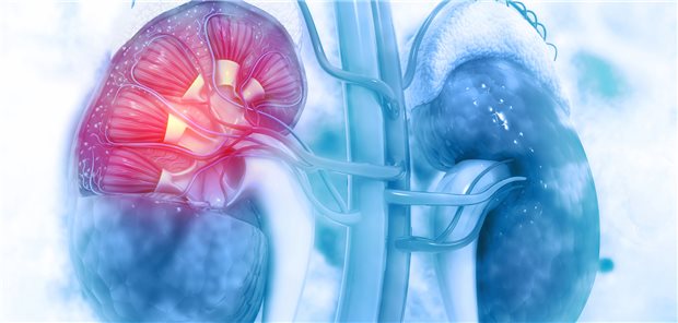 Nieren: Wissenschaftler haben untersucht, welchen Einfluss ein gesunder Lebensstil zum Beispiel auf diabetische Nephropathien hat.