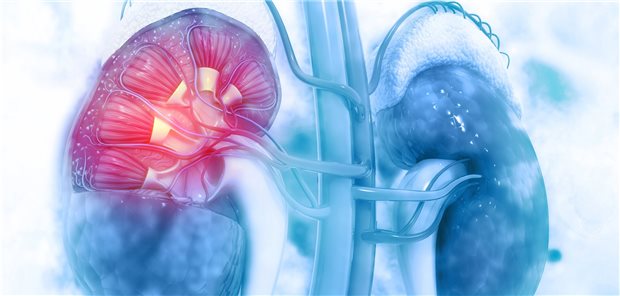 CKD bei COVID-Kranken