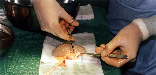 Kaum Auffälligkeiten in der Transplantationsmedizin Nierenentnahme: Ob bei der Transplantation von Organen alles mit rechten Dingen zugeht, überprüfen seit 2012 Prüfungs- und Überwachungskommission.
