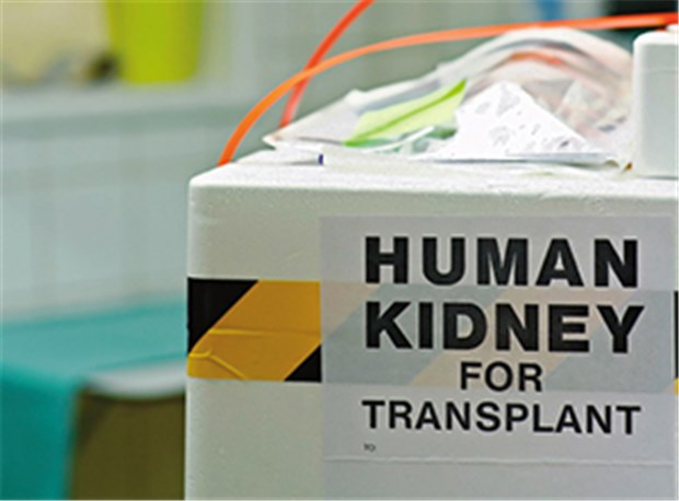 Diskussion um Organe von HIV-Infizierten Nierentransplantat: In den USA wird nun darüber diskutiert, künftig auch Organe von HIV-positiven Spendern einzusetzen.