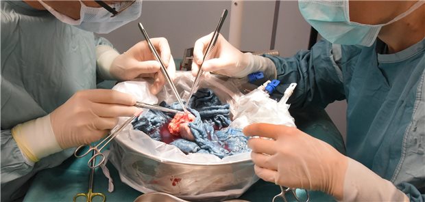 Urteil: Keine frühere SARS-CoV-2-Impfung für Organtransplantierten Eine Spenderniere wird an der Uniklinik Leipzig transplantiert.