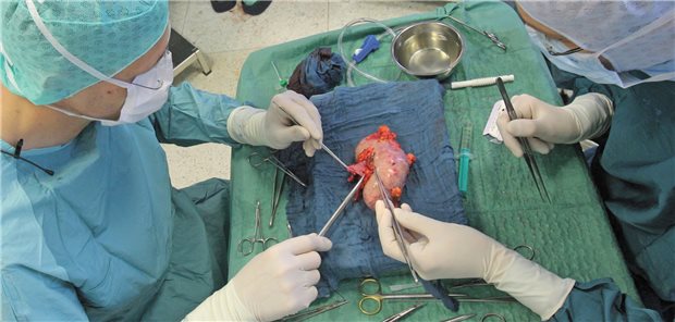 Ein zeitgemäßes Lebendspenderecht könnte Leben retten Nierentransplantation: Vor allem dieses Organ wird relativ häufig von Lebendspendern gegeben, häufig an schwer erkrankte Angehörige.