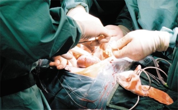 Dauerperfusion schützt Spendernieren auf dem Weg zum Empfänger Nierentransplantation in einer Klinik in Hessen. Mit einer Dauerperfusion beim Transport funktionieren die übertragenen Organe oft besser.