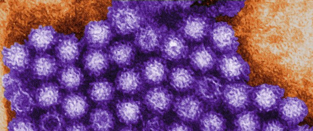 Brechdurchfall mit Spätfolgen Noroviren: Kleiner Erreger mit Auswirkung.