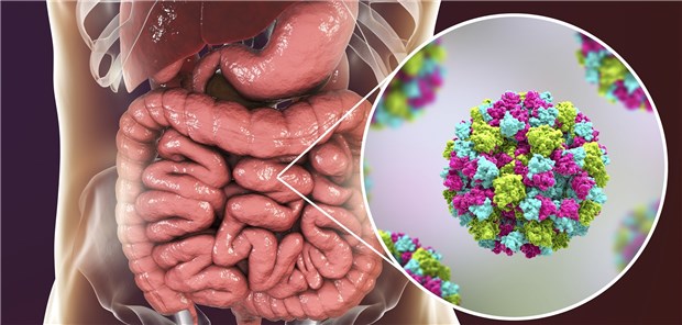 Norovirus-Infektion: Spielt beim erhöhten Risiko für virale Gastroenteritiden bei PPI-Einnahme das Mikrobiom eine Rolle?