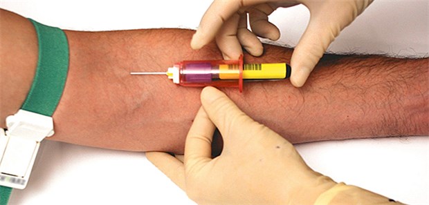 Nüchternlipidwerte unterscheiden sich kaum von den nichtnüchtern gemessenen Werten.