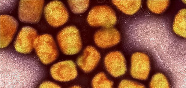 Eine kolorierte transmissionselektronenmikroskopische Aufnahme von Partikeln des Affenpockenvirus (Gold), kultiviert und gereinigt aus einer Zellkultur, aufgenommen in der NIAID Integrated Research Facility