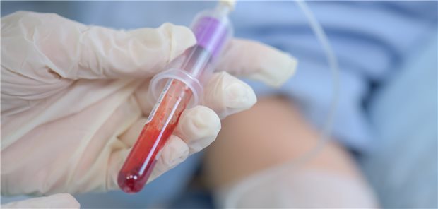 Nur etwas Blut reicht aus, um mit einer unter anderem in Schweden entwickelten Methode Krebs frühzeitig zu erkennen. Dies geht aus einer Studie hervor.