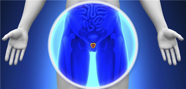 Schematische Darstellung der Prostata