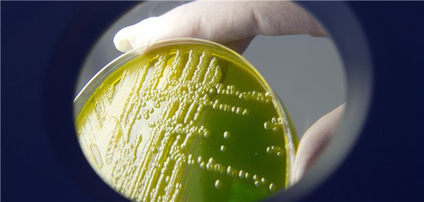 Ob bakterielle oder virale Infekte – beide führen zu einem Verbrauch an VitaminC. Ein Mangel kann die Abwehrlage des Organismus stark einschränken.