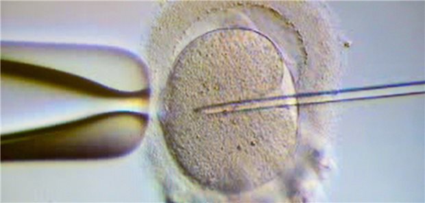Dargestellt wird eine künstliche Befruchtung.