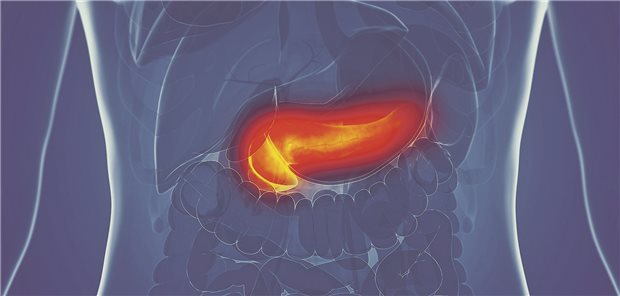 Ob eine akute Pankreatitis wieder auftritt, hängt auch davon ab, welche Ursache zugrunde liegt. Das ist das Ergebnis einer Metaanalyse.
