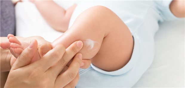 Ob eine stadardisierte Hautpflege bei Babys mit Risiko für atoptische Dermatitis dazu führt, dass diese keine Neurodermitis entwickeln, wurde in Studie untersucht.
