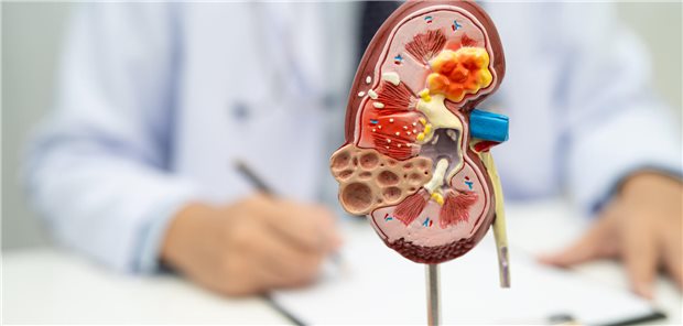 Ein Arzt erklärt seinem Patienten anhand eines anatomischen Modells der menschlichen Niere die Behandlung einer chronischen Nierenerkrankung. 