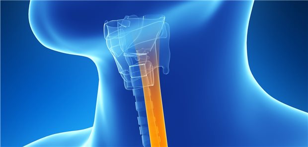 Ösophagus: Der Verdacht auf eine eosinophile Ösophagitis sollte auf der Überweisung vermerkt werden.